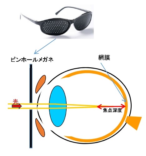 ピンホールメガネで視力回復